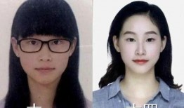 男孩整容27次爆料视频,揭秘男孩整容之路的辛酸历程